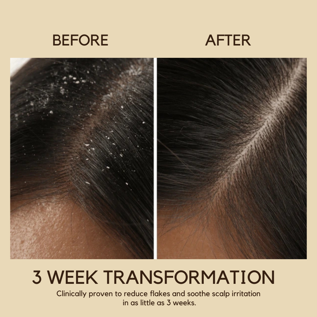 Flake Control + Strengthen Duo - With Batana Oil